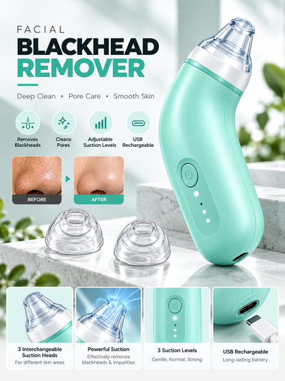 Electric Blackhead Remover Vacuum – USB Rechargeable Pore Cleaner with 2 Replaceable Suction Heads