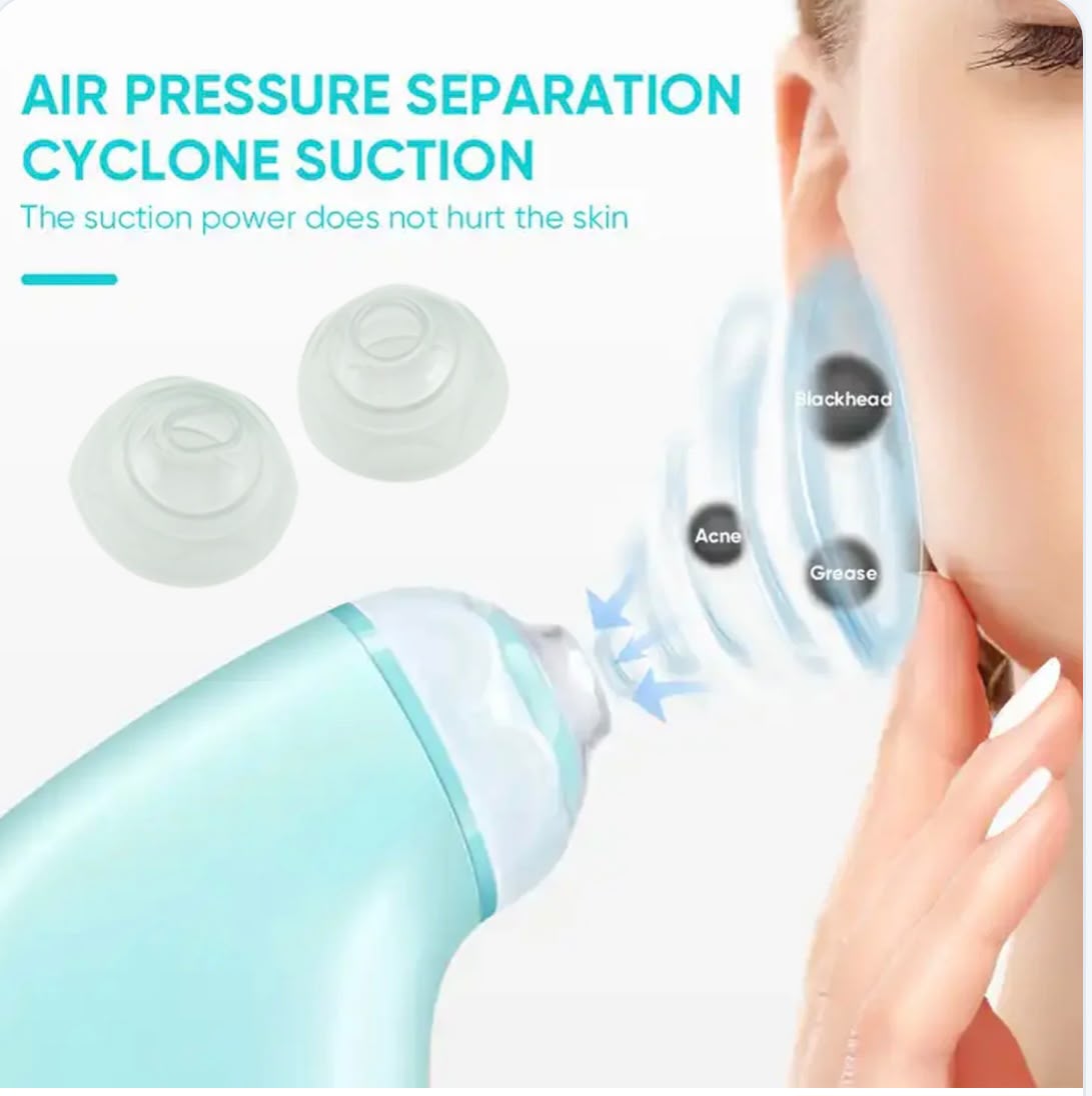 Electric Blackhead Remover Vacuum – USB Rechargeable Pore Cleaner with 2 Replaceable Suction Heads